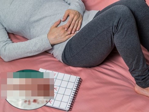 Nữ bệnh nhân có 68 khối u xơ tử cung, có dấu hiệu này khi kinh nguyệt nên khám ngay
