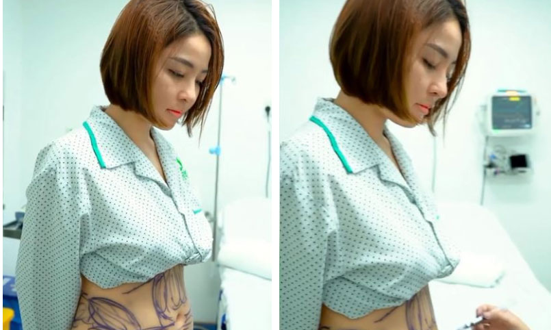 Nửa năm sau scandal, hot girl Trâm Anh công khai hút mỡ bụng và tái xuất bằng loạt động thái cực khó hiểu-2