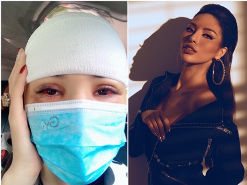 Nữ siêu mẫu Vbiz tung ảnh thương tích đầy mình, bị giam trong nhà đánh đập suốt 1 năm, cắt cả tóc, dí đầu vào bồn cầu-11