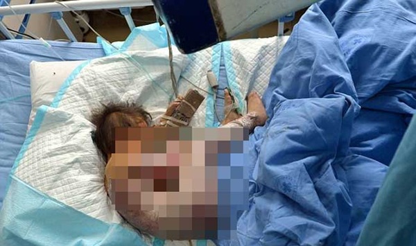 Cậu bé 6 tuổi chết thảm vì bị bố ruột ép uống nước sôi sau khi nghi ngờ con bị quỷ ám-1