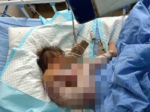 Cậu bé 6 tuổi chết thảm vì bị bố ruột ép uống nước sôi sau khi nghi ngờ con bị quỷ ám