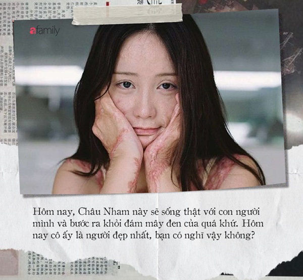 Cả gan cự tuyệt tình cảm của đại thiếu gia, nữ sinh xinh đẹp bị thiêu sống, hủy hoại cuộc đời, hung thủ lãnh án nhẹ nhàng nhờ gia thế khủng-6