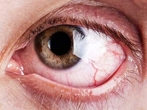 9 dấu hiệu bất thường trên đôi mắt cảnh báo bệnh tật nguy hiểm