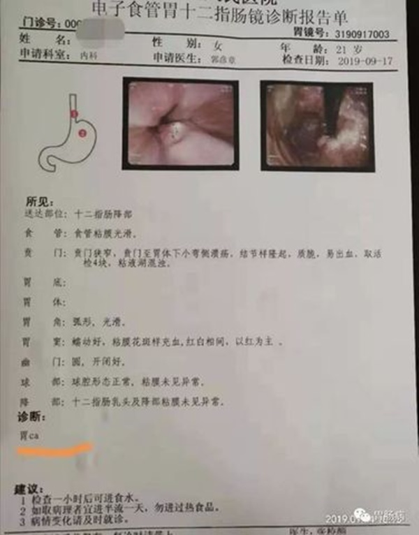 Cô gái 21 tuổi đã bị ung thư, bác sĩ cảnh báo thói quen xấu ở giới trẻ-1