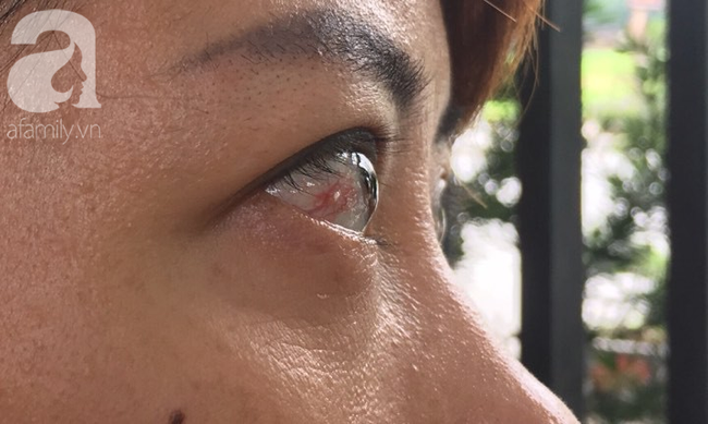 Kinh hãi nước sinh hoạt đen như cống ở chung cư Hà Nội: Người dân bị đau mắt, dị ứng không dám sử dụng-2