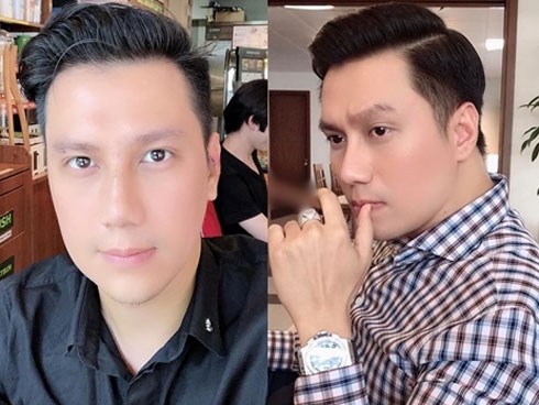 Qua rồi cái thời bị chê phẫu thuật lỗi, nhan sắc Việt Anh hiện tại đã chuẩn soái ca và được khen