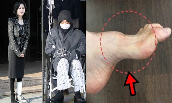 Đế chế Samsung và căn bệnh di truyền đáng sợ mang tên teo cơ MÁC, thừa mứa” tiền quyền cũng không thể chữa khỏi-7