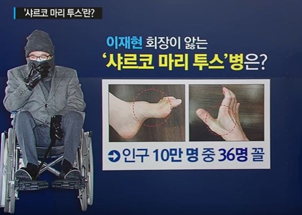 Đế chế Samsung và căn bệnh di truyền đáng sợ mang tên teo cơ MÁC, thừa mứa” tiền quyền cũng không thể chữa khỏi-8