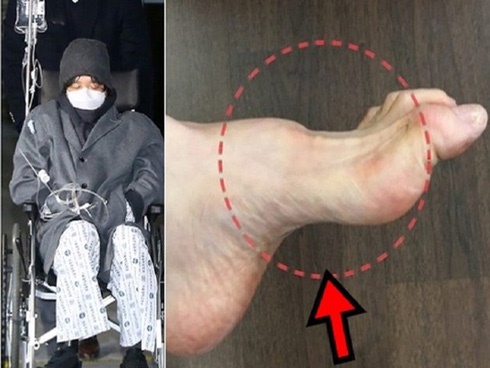 4 căn bệnh dễ di truyền cho nam hơn nữ, vợ chồng nếu mắc phải nên mong sinh con gái-6