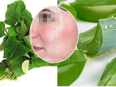 Lần nào makeup xong cũng bị nổi mụn, hãy áp dụng ngay 2 công thức dưới đây
