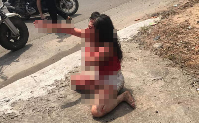 Phẫn nộ: Cô gái bị người tình cũ rạch mặt tàn ác-1