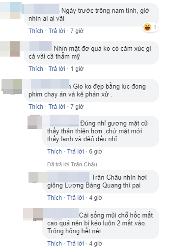 Đã thay đổi gương mặt khá nhiều nhưng Việt Anh vẫn bị chê là thất bại của phẫu thuật thẩm mỹ vì điều này-4