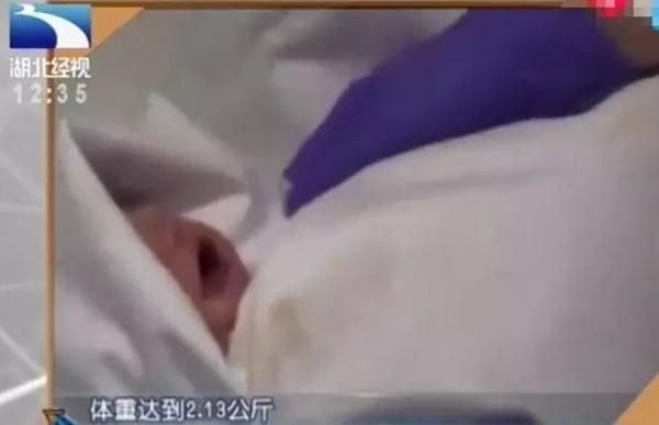 Thai phụ bị chết não, sau 117 ngày vẫn sinh bé gái khỏe mạnh-2