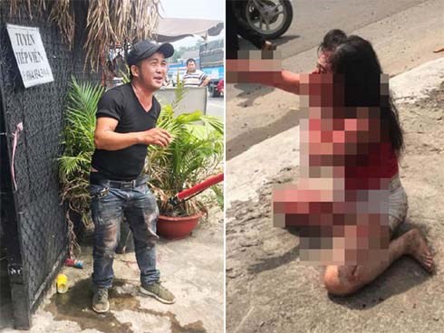 Cô gái bị rạch mặt dã man: Chồng hờ xuống tay tàn nhẫn vì níu kéo tình cảm bất thành
