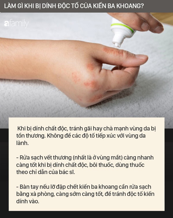 Độc tố của kiến ba khoang mạnh gấp 12-15 lần rắn hổ mang: Nhận biết kiến ba khoang và phòng tránh chất độc của chúng dính vào da-5