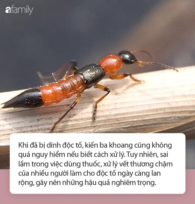 Có vết thương và bị dính độc kiến ba khoang thì nên bôi thuốc gì cho đỡ đau rát và nhanh khỏi nhất?-1