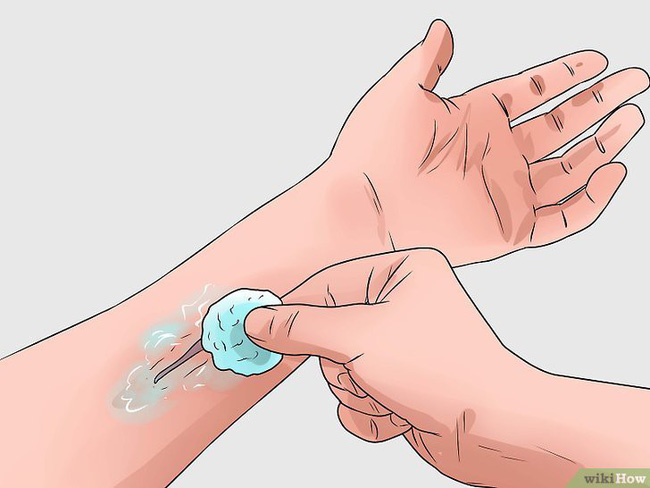 Có vết thương và bị dính độc kiến ba khoang thì nên bôi thuốc gì cho đỡ đau rát và nhanh khỏi nhất?-5