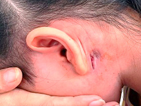 Nhiễm vi khuẩn không xác định loài, bé 22 tháng tuổi ở Hải Dương tử vong-3