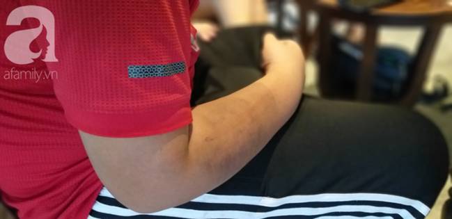 Nghi án bé trai bị bố ruột dùng dây điện bạo hành, đánh bầm tím khắp người vì viết chữ xấu-4