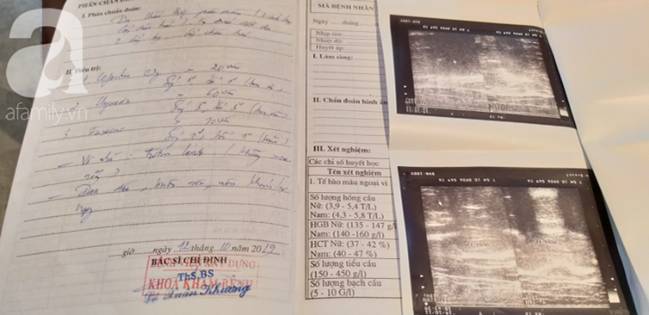 Nghi án bé trai bị bố ruột dùng dây điện bạo hành, đánh bầm tím khắp người vì viết chữ xấu-8