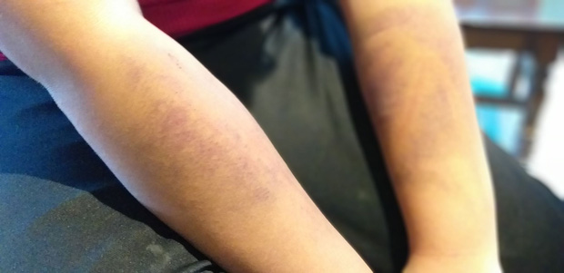 Người bố trần tình về việc dùng dây điện đánh con: Xót con thì ai chả xót, từ hôm đánh nó đến giờ tôi cũng không ngủ được”-1