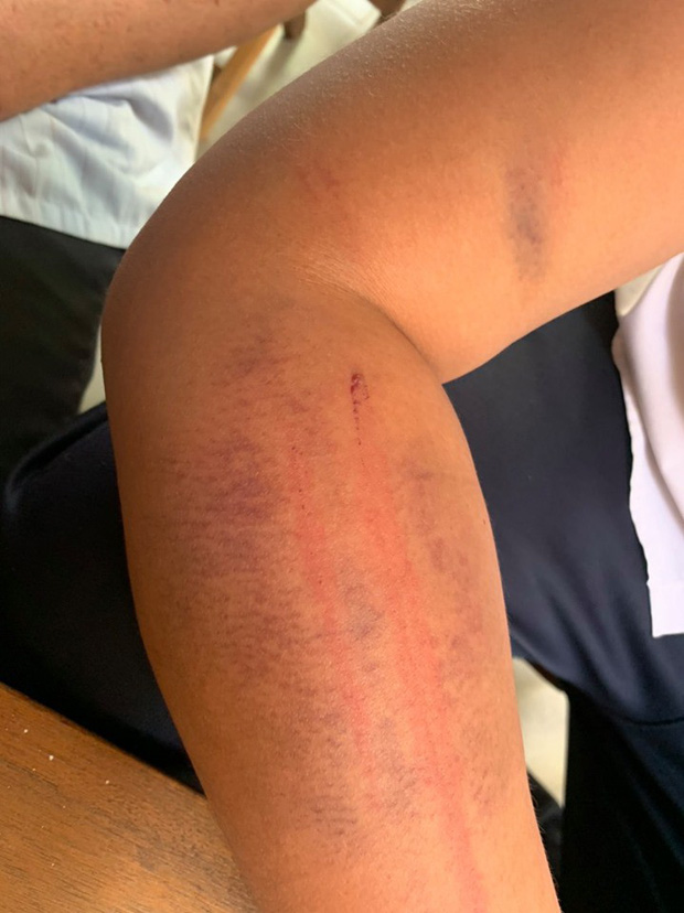 Người bố trần tình về việc dùng dây điện đánh con: Xót con thì ai chả xót, từ hôm đánh nó đến giờ tôi cũng không ngủ được”-2