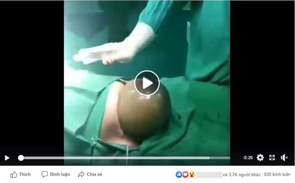 Clip kì diệu ghi lại khoảnh khắc em bé nằm nguyên trong túi ối nhưng đã giơ 2 tay chào thế giới-2