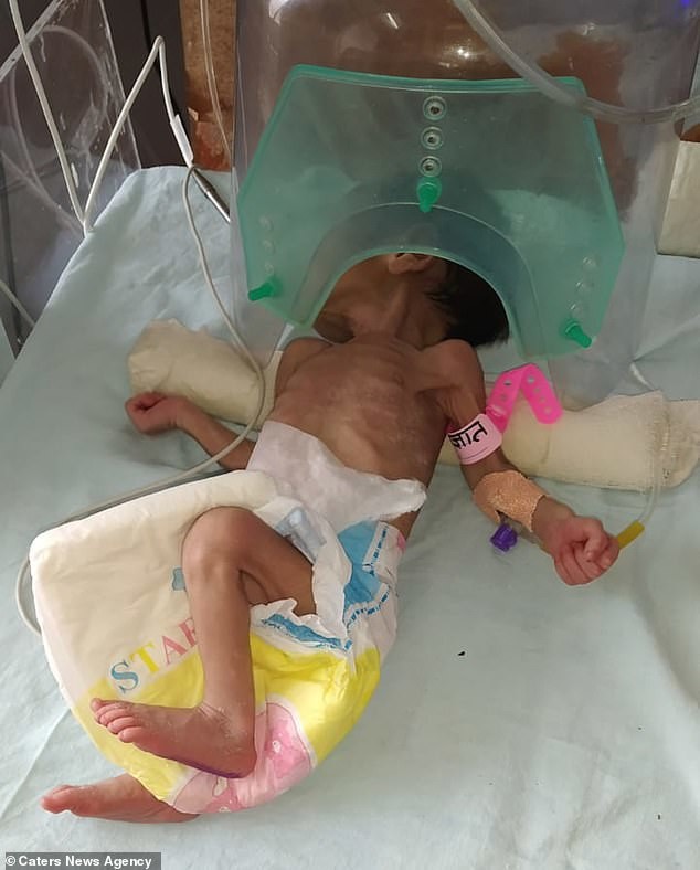 Bị chôn sâu gần 1 mét dưới đất, bé gái 3 ngày tuổi gây ngỡ ngàng khi còn sống-2