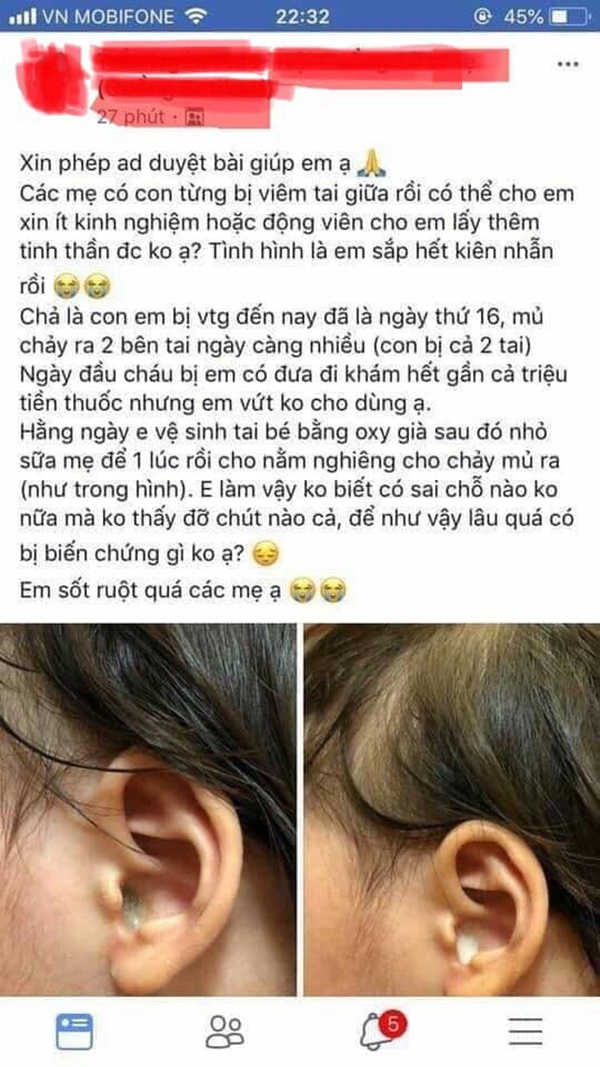 Nhỏ sữa mẹ vào mắt và tai để chữa bệnh, mẹ chết lặng khi con mù mắt, thủng màng nhĩ: Bài học đắt giá vì mù quáng cầu cứu MXH chữa bệnh cho con-3
