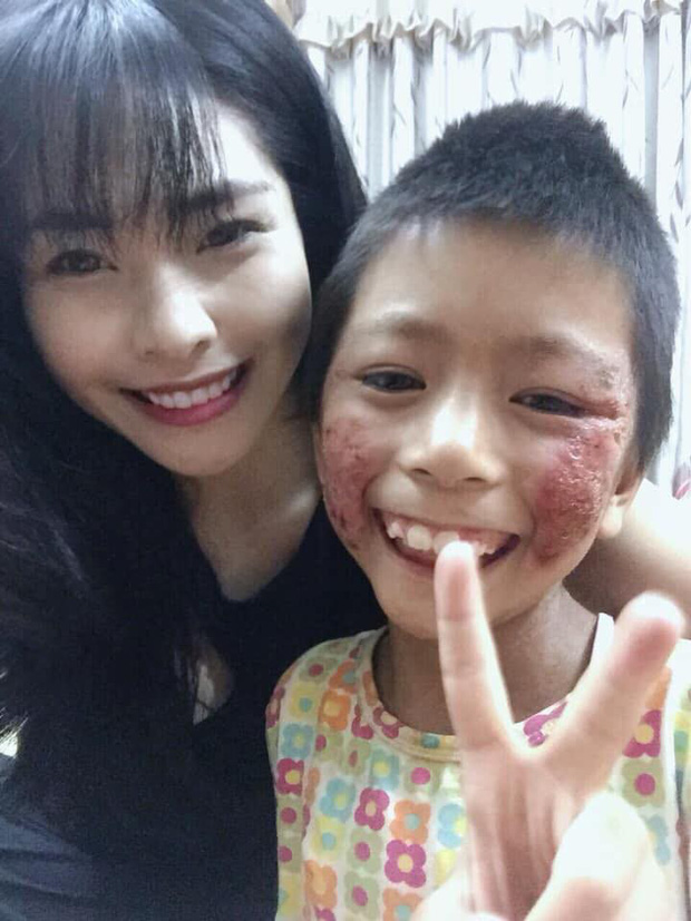 Cô giáo 9X xinh đẹp nhận nuôi đứa trẻ lở loét mặc lời kì thị: Con gái chưa chồng, tự nhiên dắt đứa con hoang ở đâu về-1