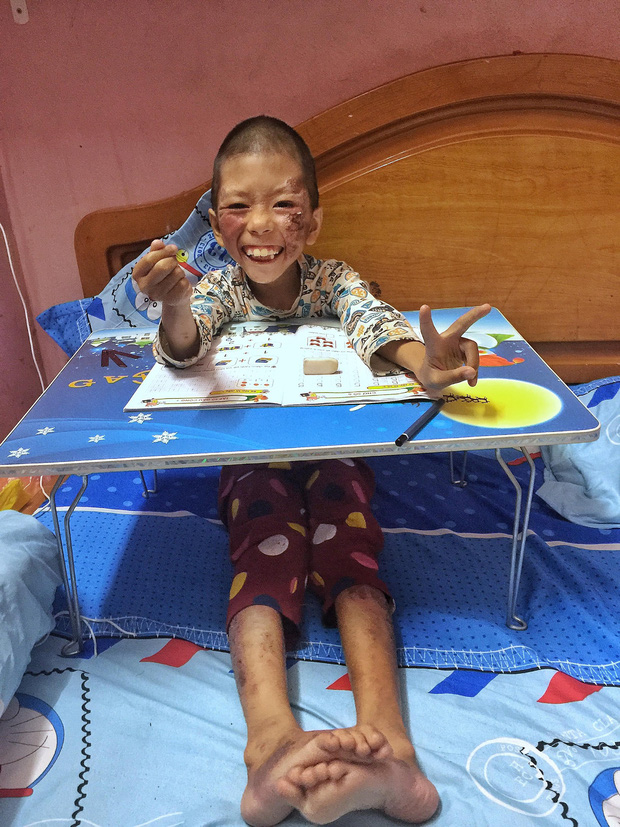 Cô giáo 9X xinh đẹp nhận nuôi đứa trẻ lở loét mặc lời kì thị: Con gái chưa chồng, tự nhiên dắt đứa con hoang ở đâu về-2