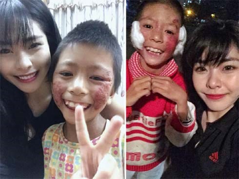 Cô giáo 9X xinh đẹp nhận nuôi đứa trẻ lở loét mặc lời kì thị: