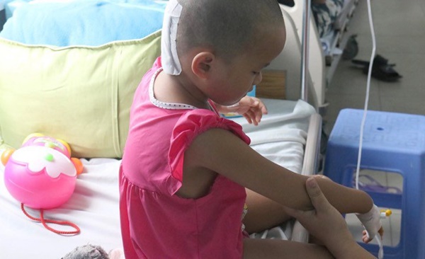 Cha mẹ chủ quan, bé gái suýt chết vì chấn thương sọ não sau té ngã-3