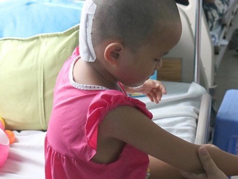 Cha mẹ chủ quan, bé gái suýt chết vì chấn thương sọ não sau té ngã