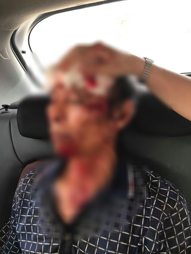 Thanh Hóa: Đang ngồi ăn cơm trong nhà, gia đình bị nhóm người lạ xông vào rút súng bắn nhập viện-1