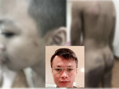 Kẻ nghi ngáo đá, sát hại ông lão 84 tuổi ở Bình Dương, cắn đứt một số bộ phận trên cơ thể-3