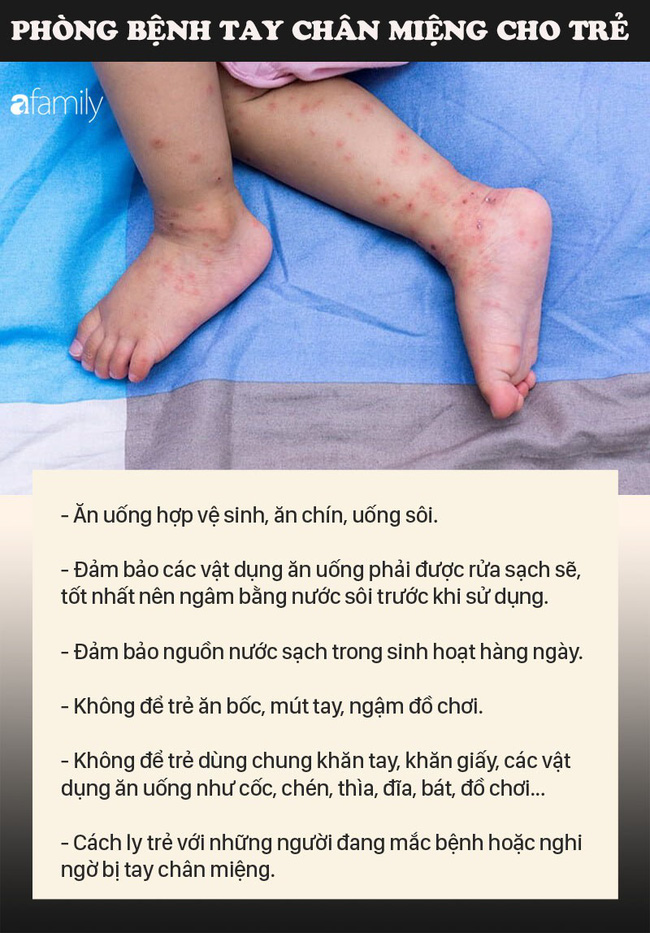 Những việc cha mẹ nào cũng nên làm để phòng bệnh tay chân miệng cho con-2