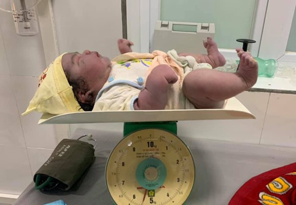 Bé gái sơ sinh nặng 5,5kg chào đời bằng phương pháp sinh thường-1