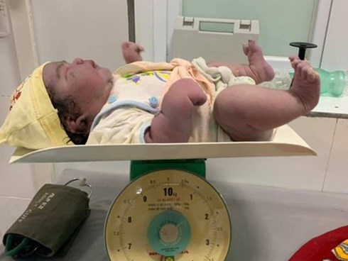 Bé gái sơ sinh nặng 5,5kg chào đời bằng phương pháp sinh thường