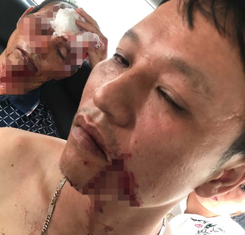 2 nữ sinh mâu thuẫn trên trường, ở nhà bố kéo người đến nổ súng giải quyết giúp con-2