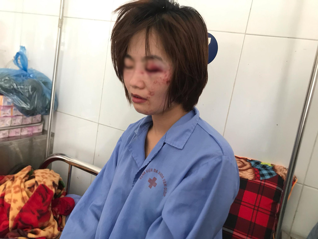 Sau khi hành hung dã man, nhóm 4 thanh niên thản nhiên vứt cho nữ phụ xe buýt 1 triệu đồng cầm lấy mà mua thuốc và dằn mặt đánh như thế vẫn còn nhẹ!-2