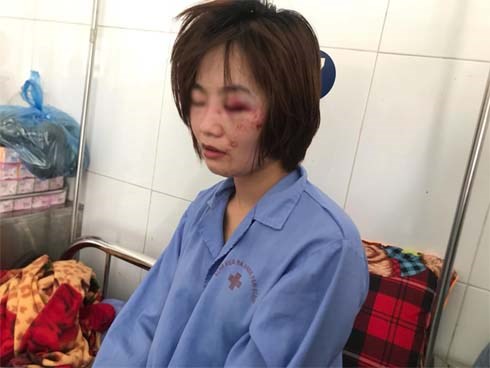 Sau khi hành hung dã man, nhóm 4 thanh niên thản nhiên vứt cho nữ phụ xe buýt 1 triệu đồng