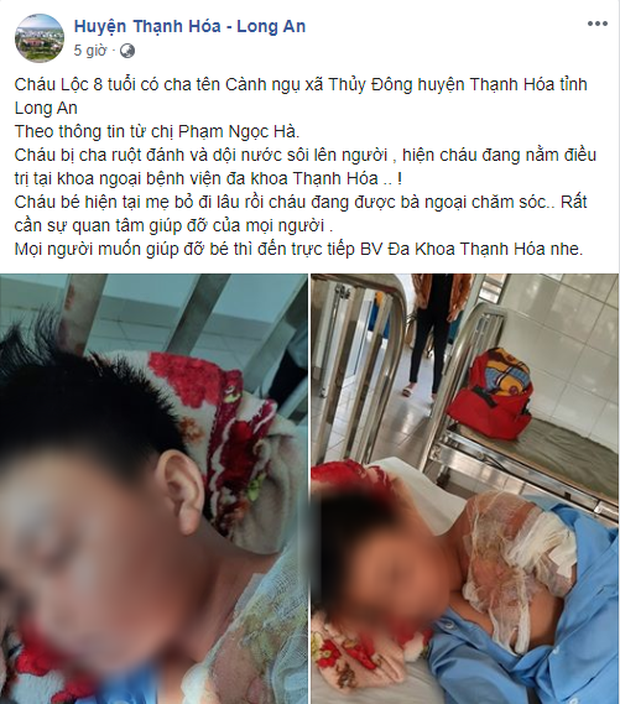 Xác minh thông tin bé trai ở Long An bị cha đẻ bạo hành, đổ nước sôi khiến bỏng nặng phải nhập viện-1