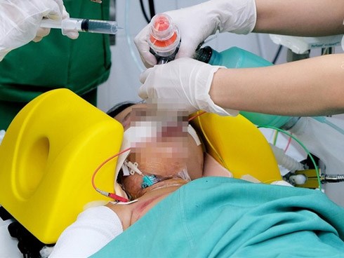 Vụ xe tải cán bố mẹ tử vong, con 5 tuổi nguy kịch: Sức khỏe bé gái hiện thế nào?