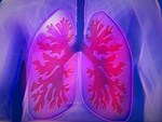 Dấu hiệu điển hình của bệnh ung thư phổi-2