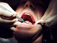 Đau răng khôn mãi mà không được bác sĩ nhổ, 1 người đàn ông treo cổ tự sát