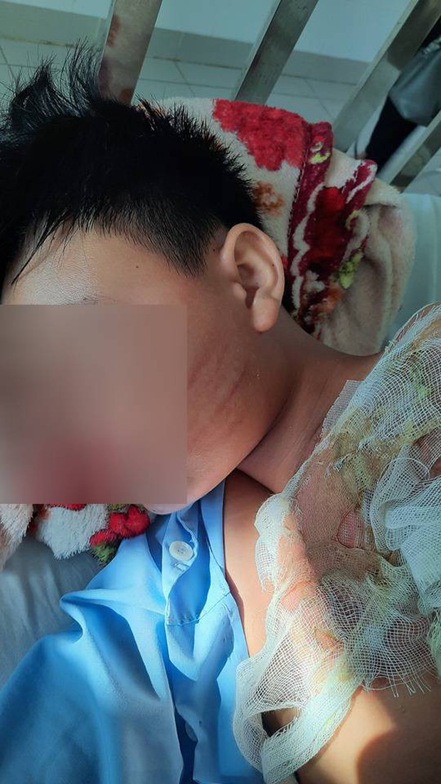 Hoàn cảnh vô cùng bi đát của bé trai nghi bị cha ruột tạt nước sôi gây bỏng nặng-2