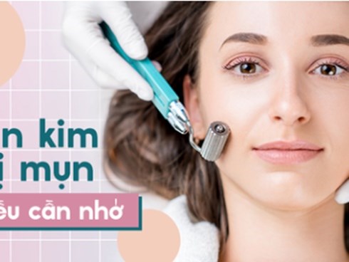 Lăn kim trị mụn: Bác sĩ da liễu khuyến cáo những lưu ý quan trọng không thể bỏ qua trước khi làm