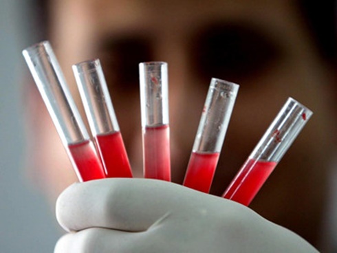 Cách giữ mạng sống của người đàn ông mang nhóm máu quý hơn vàng-4