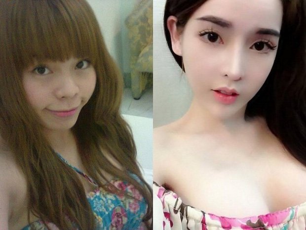 Chi gần 50 triệu đồng để cắt mí tại spa của hot girl dao kéo Vân Tokyo, cô gái sống dở chết dở vì không nhắm được mắt-1